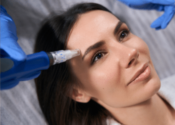 Microneedling + Bienpeel