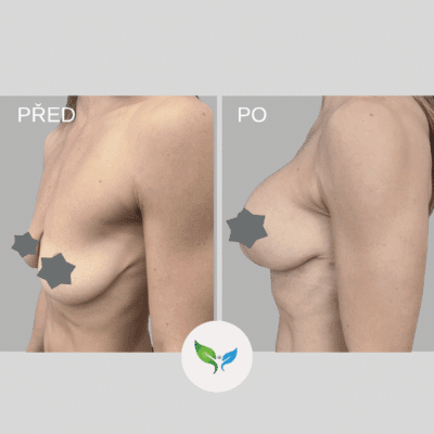 Modelace a augmentace