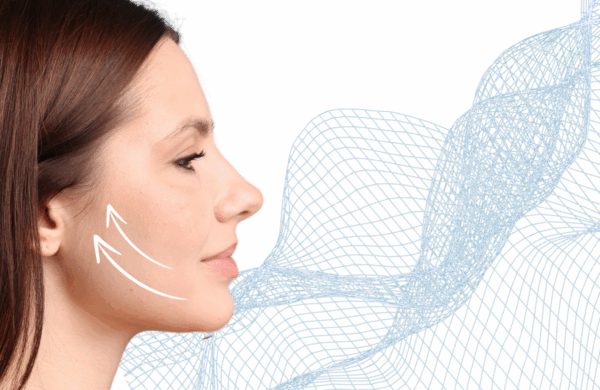 Mini facelift My Best Care