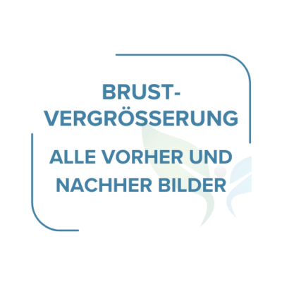 Brustvergroserung