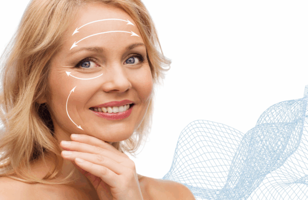 SMAS Facelift unter Vollnarkose