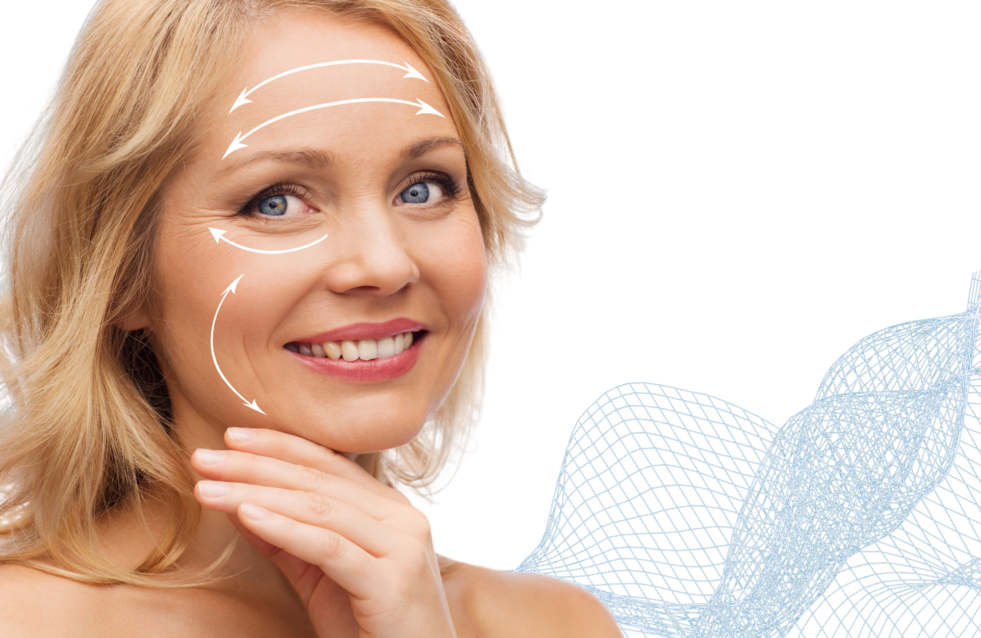 SMAS Facelift unter Vollnarkose