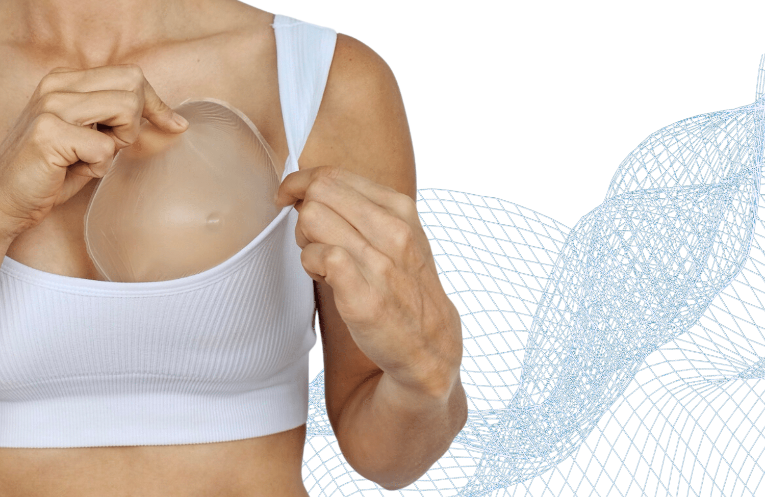 Brustimplantate entfernung