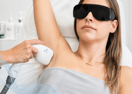 Laserová epilace s 25% slevou