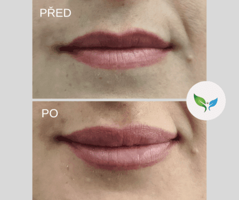 rty zvětšení (MUDr. Pasiková)